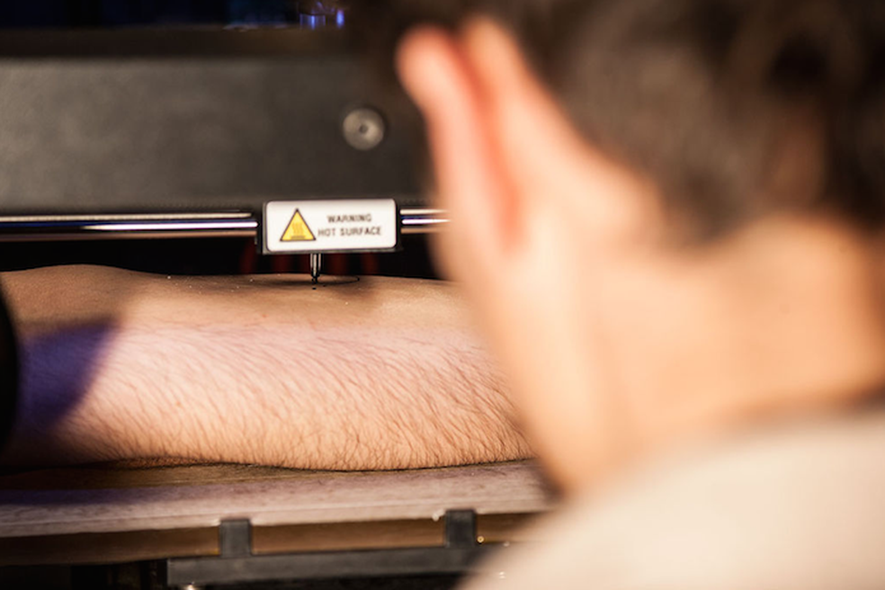 Impressora 3D adaptada se transforma em máquina de tatuagem (Foto: Divulgação)
