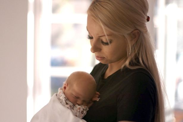 Becky com seu bebê Annie, que teve um tumor removido quando estava no útero (Foto: Reprodução: The Mirror/ Canal 4)
