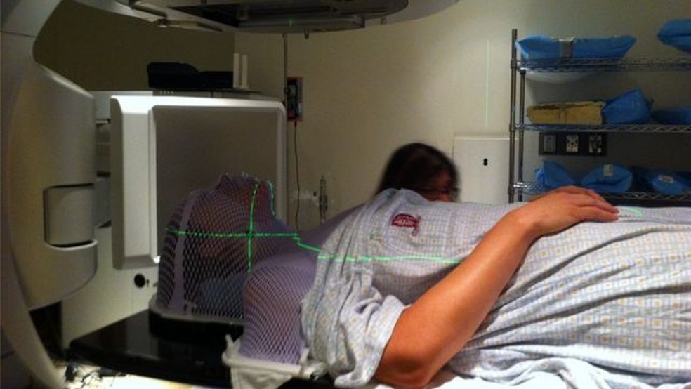 O tratamento de Sarah McDonald inclui quimio e radioterapia simultâneas — Foto: SARAH MCDONALD/BBC