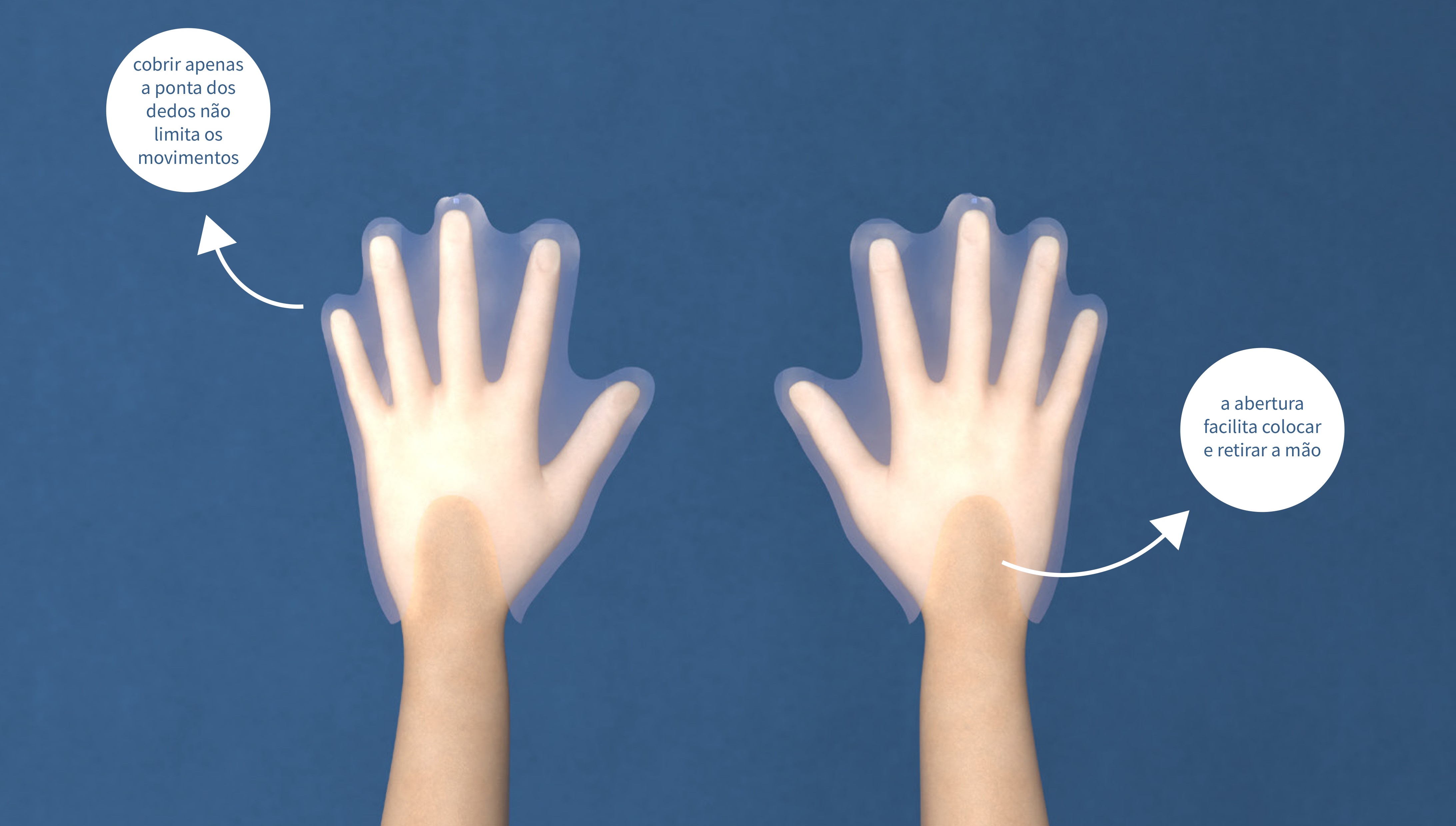 A luva possui um velcro em cada dedo, tornando possível grudar a palma de uma luva na outra, retirando-a sem contato com a parte externa (Foto: Divulgação)