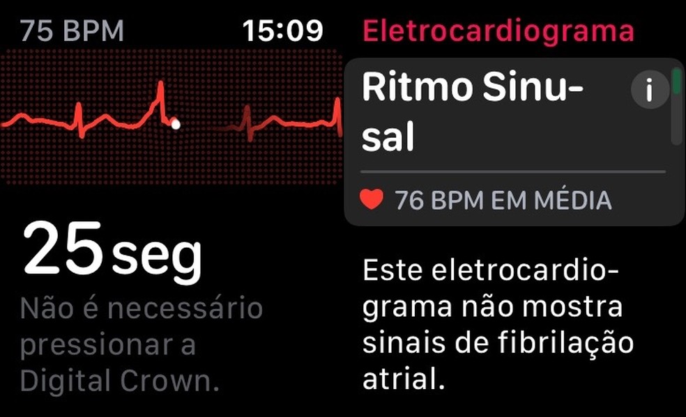 Aplicativo ECG no Apple Watch já esta disponível no Brasil — Foto: Reprodução/Willian Max