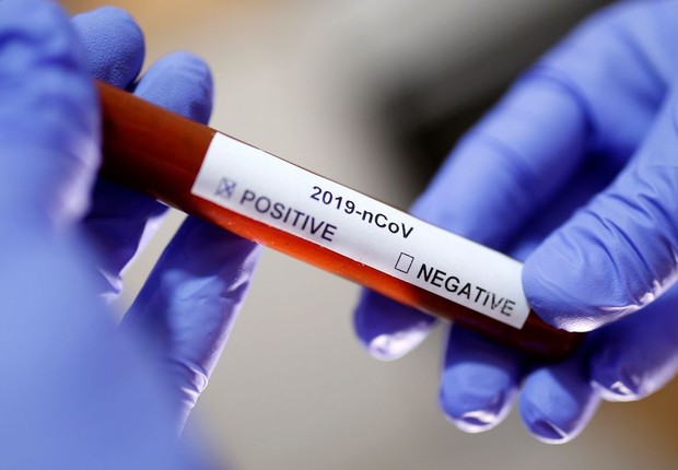 Catalunha: cientistas desenvolvem medicamento contra novo coronavírus (Foto: Reuters via Agência Brasil )