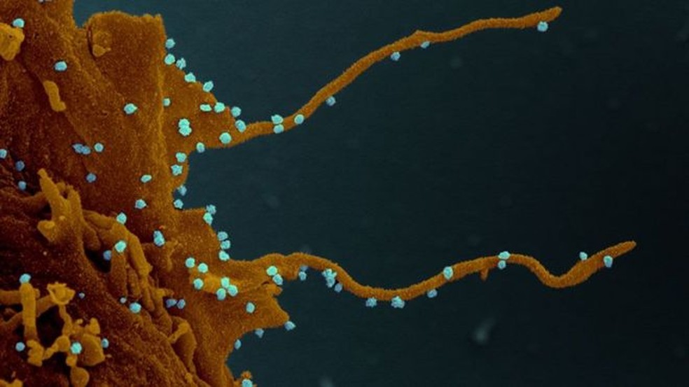 A célula infectada, seguindo as instruções do vírus (em azul), desenvolve longos tentáculos que permitem a infecção de outras células — Foto: Elizabeth Fischer/Microscopy Unit NIH/NIAID/BBC