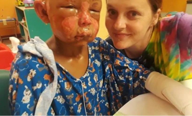 Julien, 7 anos, se recupera da queimadura em hospital (Foto: Reprodução Go Fund Me, site de "vaquinha" virtual)