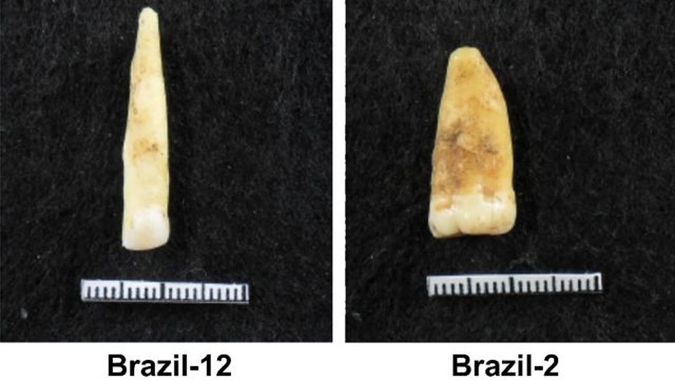 Dentes tendem a ter melhor preservação do que os ossos, explica cientista — Foto: LAB. ARQUEOLOGIA BIOLÓGICA E FORENSE UFPE/BBC