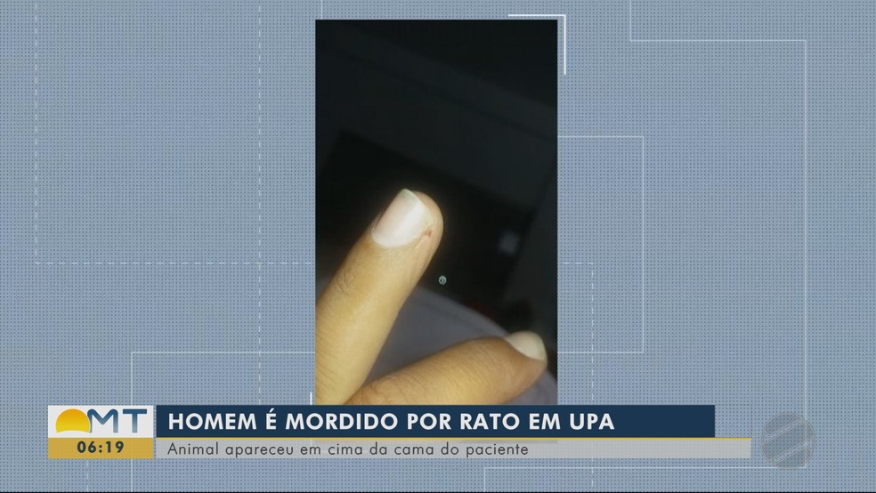Paciente mostra o dedo mordido pelo rato na UPA de Rondonópolis — Foto: TV Centro América/Reprodução