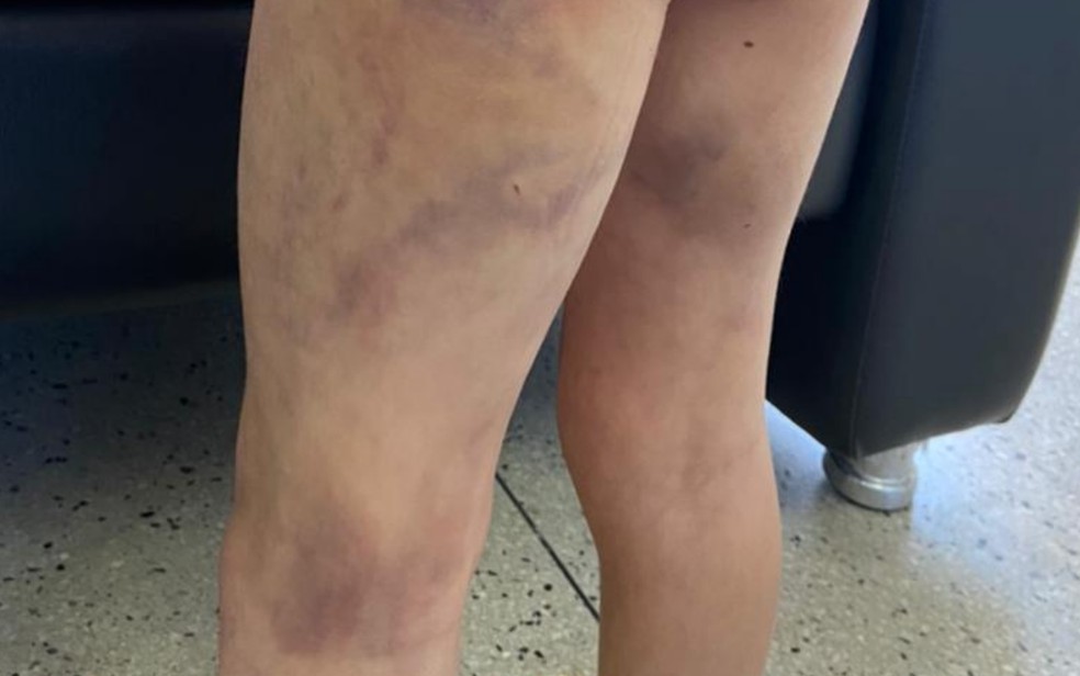 Criança de 6 anos e adolescente de 14 são agredidos por mãe e companheira em Aparecida de Goiânia — Foto: Divulgação/DPCA