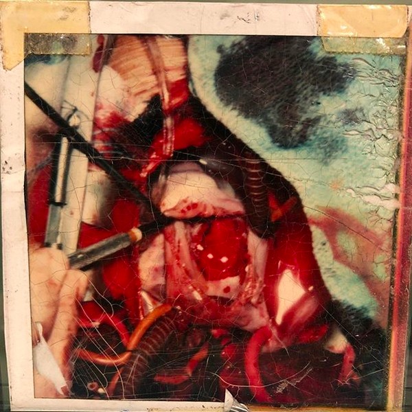 O ator Skeet Ulrich compartilhou uma foto da cirurgia no coração feita por ele quando tinha apenas 10 anos (Foto: Instagram)