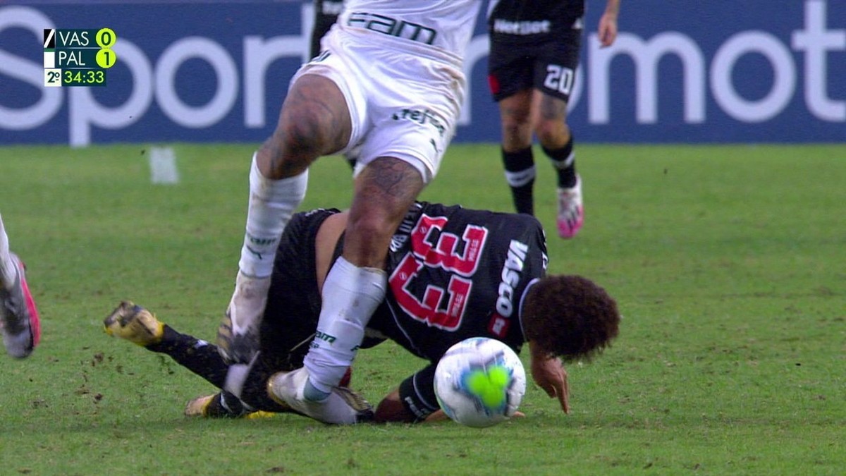Felipe Melo Has A Broken Ankle And Embezzles Palmeiras Palm Trees For Up To Four Months