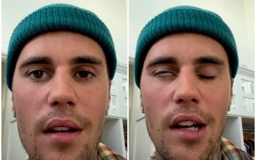 Justin Bieber diz que metade de seu rosto ficou paralisado e cancela shows até melhorar