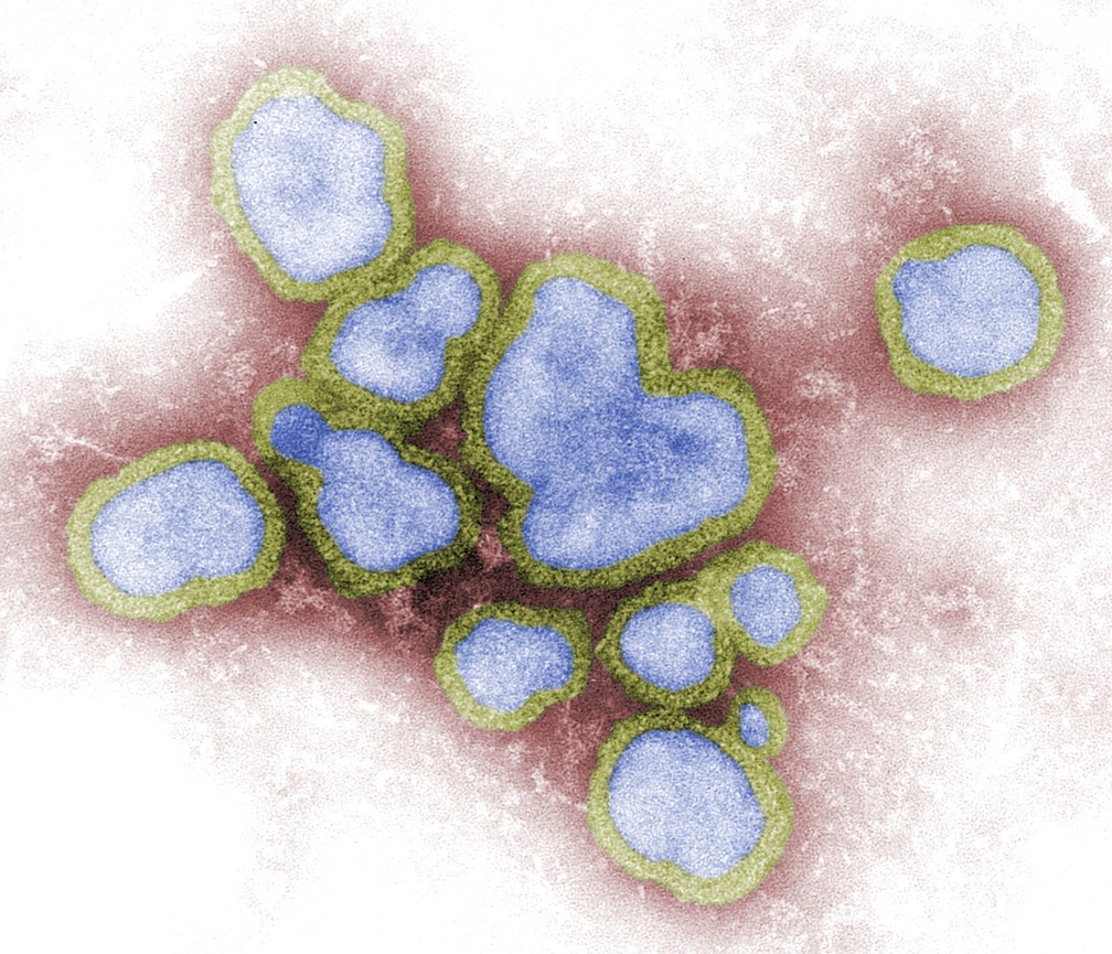 Imagem de microscopia mostra vários vírus de influenza A, causadores da gripe. — Foto: CDC/ F. A. Murphy