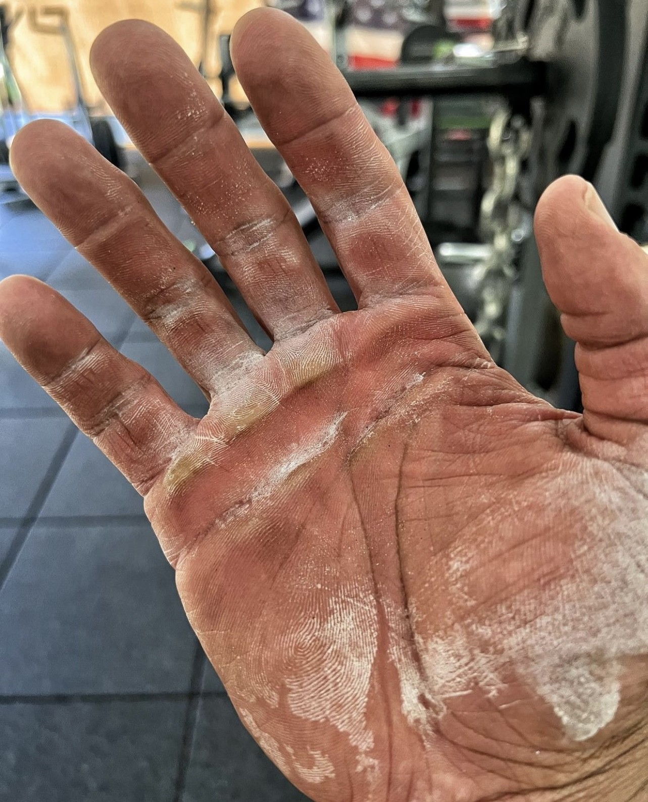 The Rock publicou recentemente sua mão estragada pelos treinos (Foto: Reprodução/Twitter)