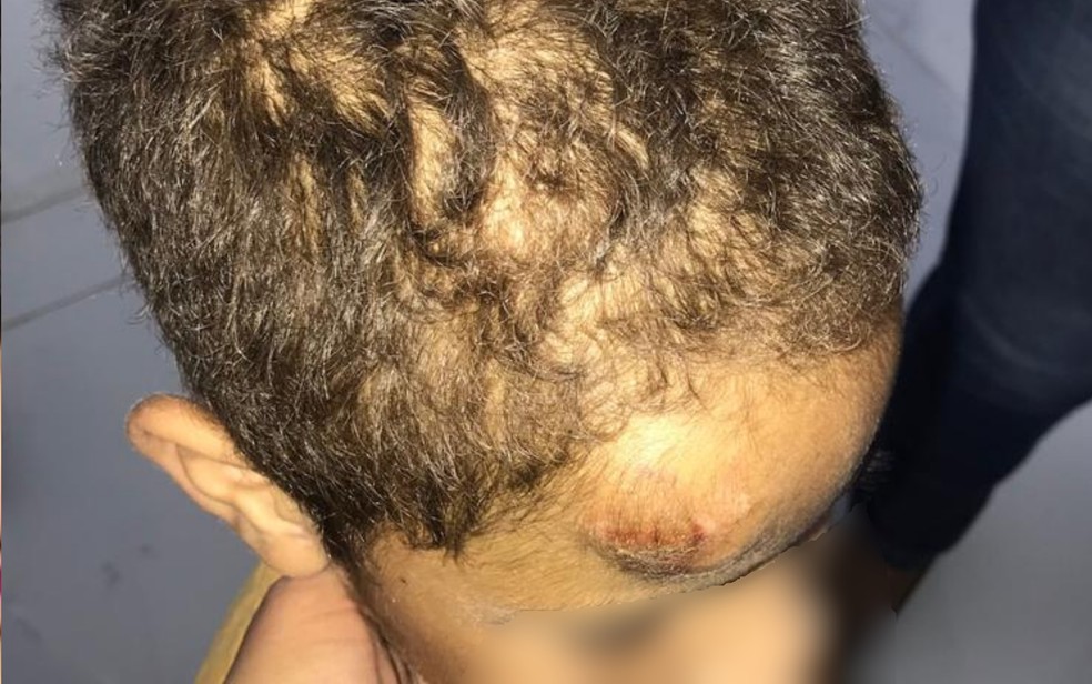 Menino de 7 anos tem 'galo' na cabeça e outros ferimentos; pai e madrasta dele foram presos suspeitos de tortura Planaltina de Goiás — Foto: Reprodução/TV Anhanguera
