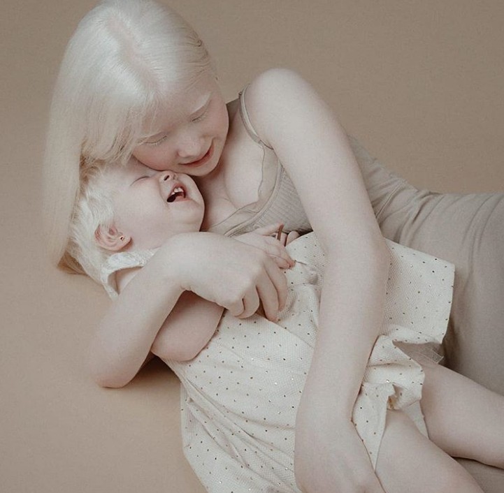 Irmãs albinas fazem sucesso nas redes sociais (Foto: Reprodução: Instagram)