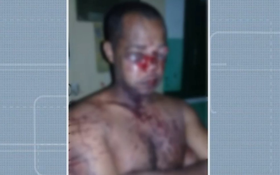 Homem alegar ter sido espancado por PMs após discussão com militar na Chapada Diamantina — Foto: Reprodução/TV Bahia
