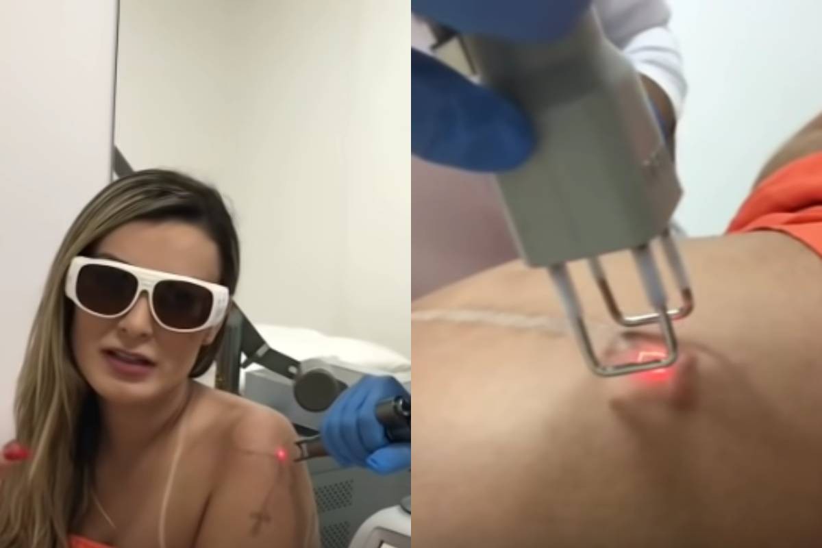 Andressa Urach remove tatuagens e cicatriz no bumbum, que ficou após retirar hidrogel
