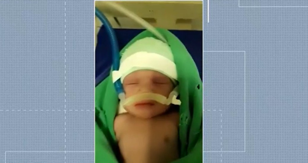 Bebê com malformação do cérebro aguarda transferência urgente para hospital com leito de UTI no sudoeste da Bahia