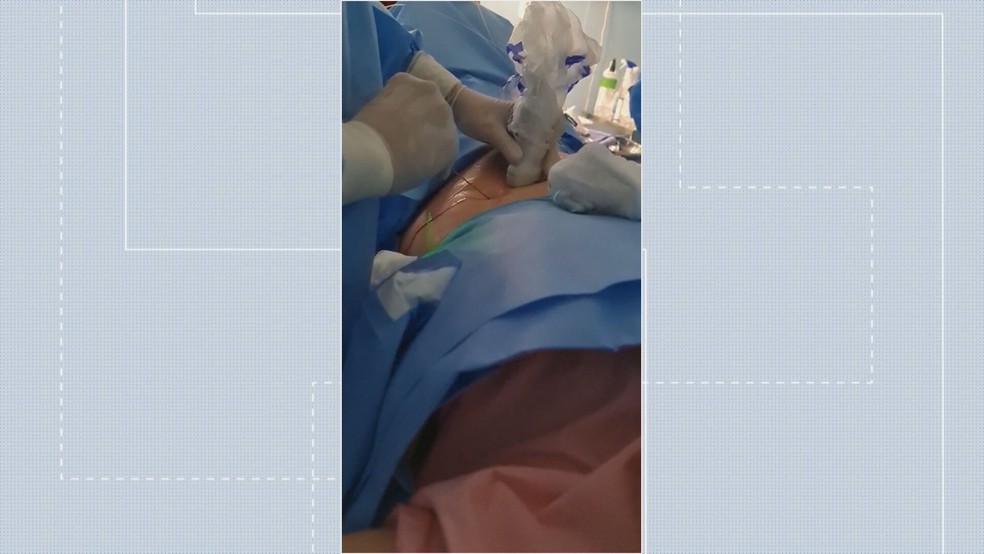 Bebê do DF passa por cirurgia dentro da barriga da mãe durante gravidez por conta de tumor no tórax — Foto: TV Globo/Reprodução