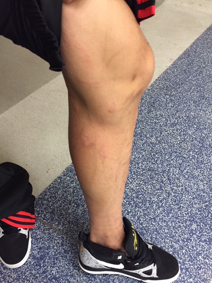 Guerrero exibe marcas das pancadas recebidas durante o jogo com o Vasco