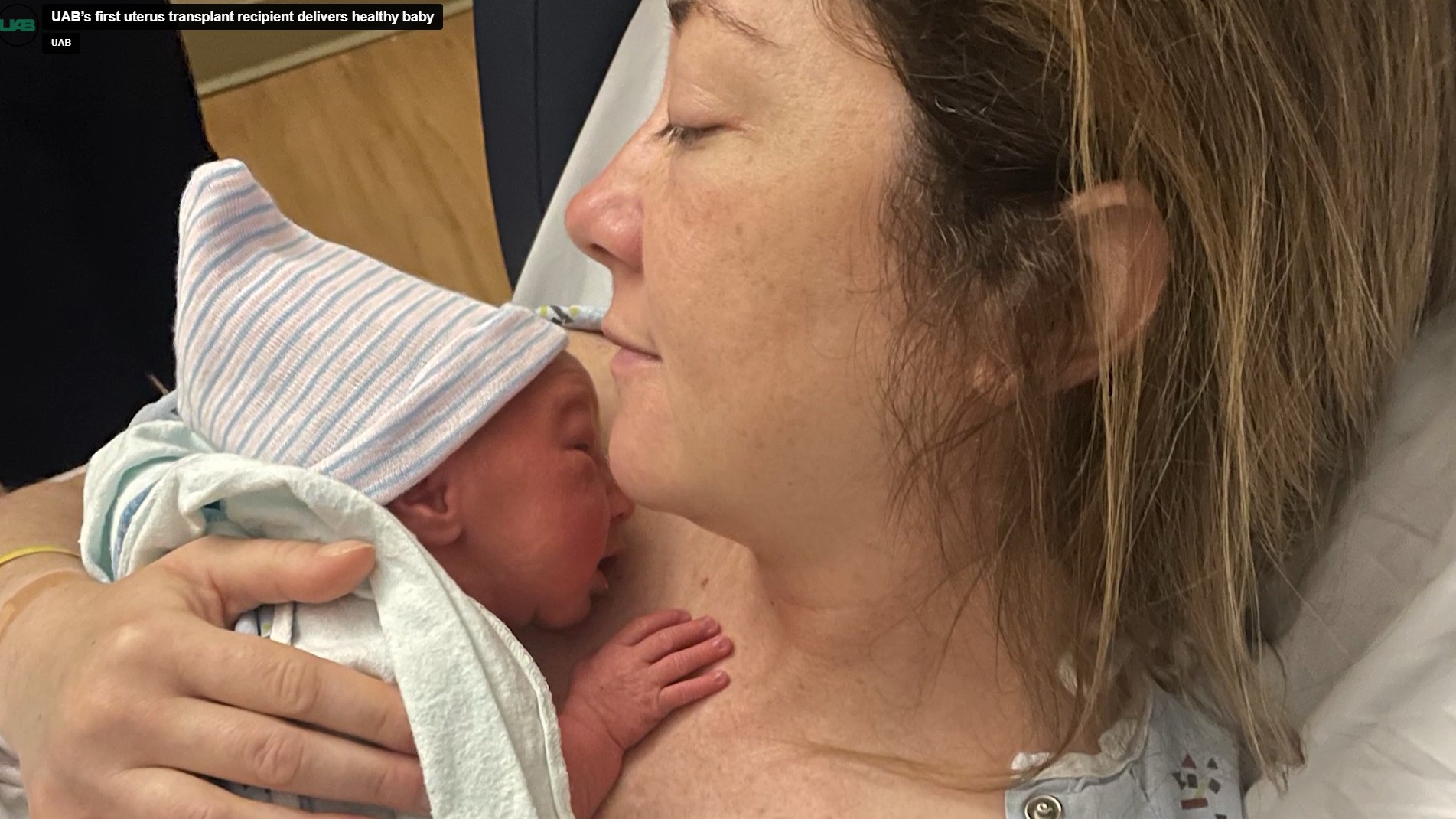 Nasce 1º bebê após transplante de útero fora de um ensaio clínico