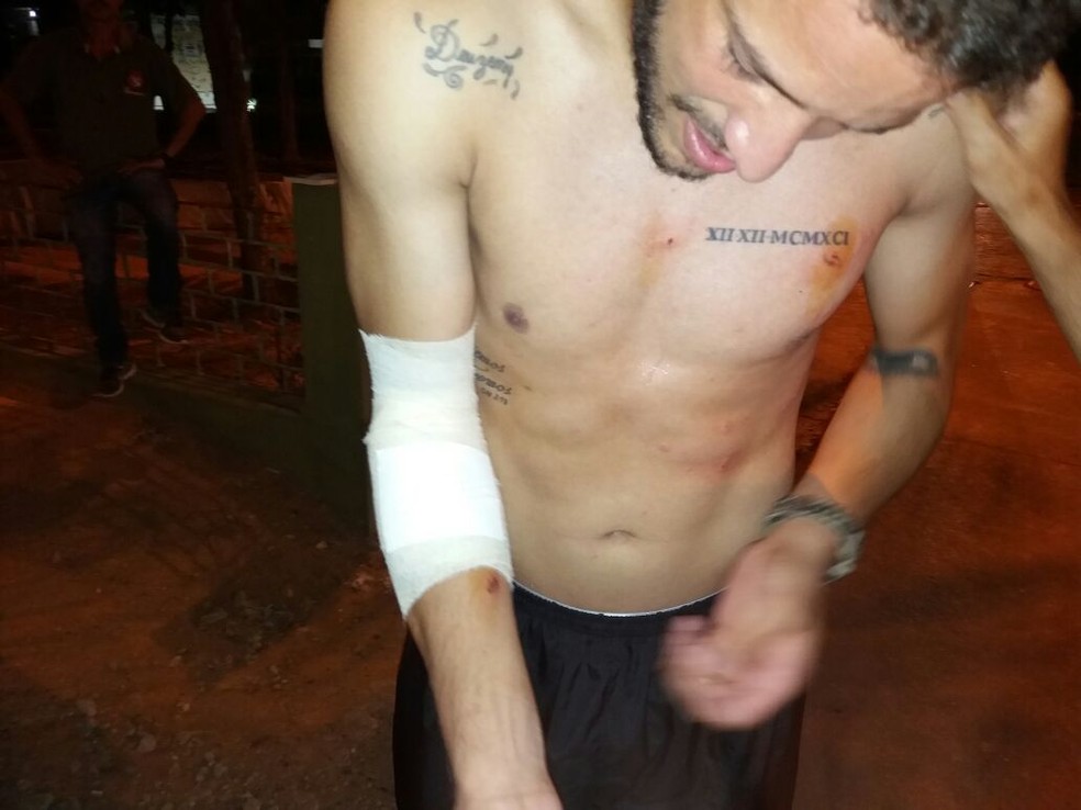 Edson Mardden sofreu cortes nas pernas e nos braços (Foto: Roberto Boroni / Ascom CRB)