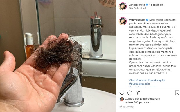 Vanessa Mesquita mostra queda dos cabelos (Foto: Reprodução/Instagram)