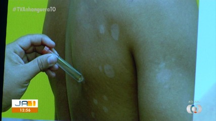 Saiba qual é a programação dos postos de saúde de Palmas no Janeiro Roxo