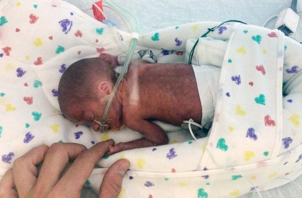  Bebê nasceu com 680 gramas durante cruzeiro em caribe  (Foto: Emily Morgan/AP)