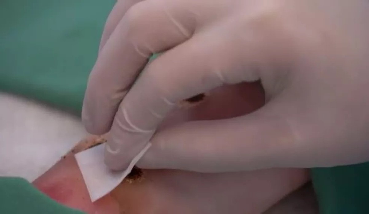 Amazonas registra mais 16 casos de var&iacute;ola dos macacos e total chega a 138  | Amazonas | G1