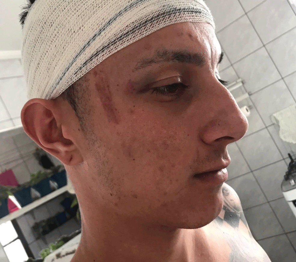 Vendedor Cesar Oliveira diz que levou sete pontos na cabeça após ser golpeado com cassetete por seguranças de estação de trem na Grande São Paulo — Foto: Divulgação/Arquivo pessoal