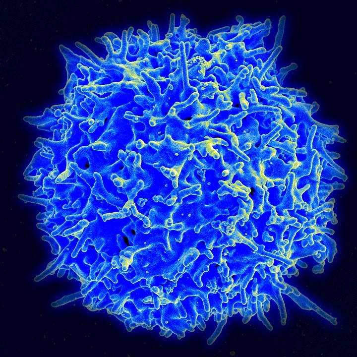 Micrografia eletrônica de um glóbulo branco do tipo linfócito T  (Foto: Wikimedia Commons )