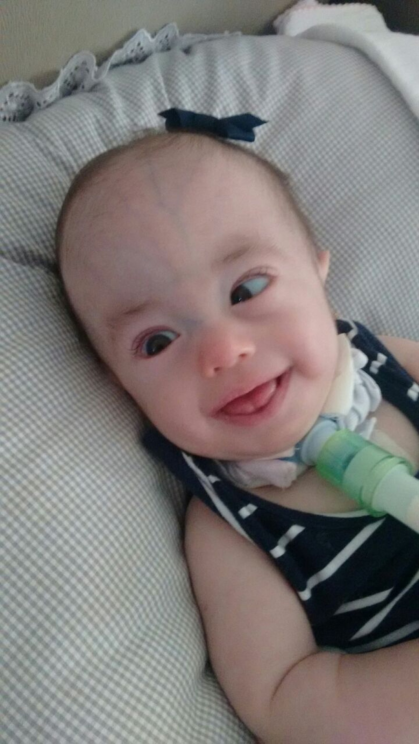 Menina com síndrome rara se recupera