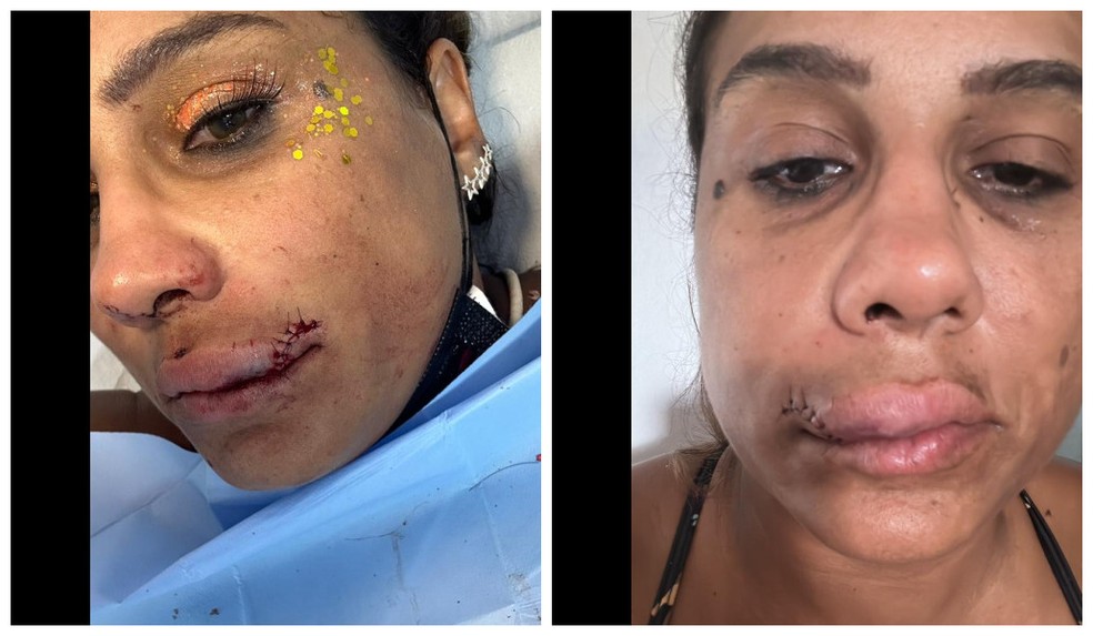 Foliona denunciou ter sido agredida em bloco no carnaval — Foto: Arquivo Pessoal