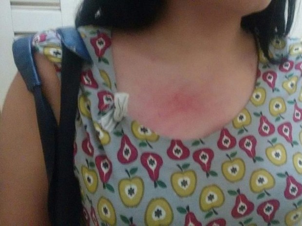 Mãe garota agredida postou imagem da filha após o crime (Foto: Facebook/Reprodução)