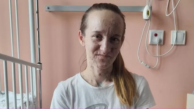Olena Selichzianowa conseguiu recuperar a visão quase totalmente (Foto: BBC)