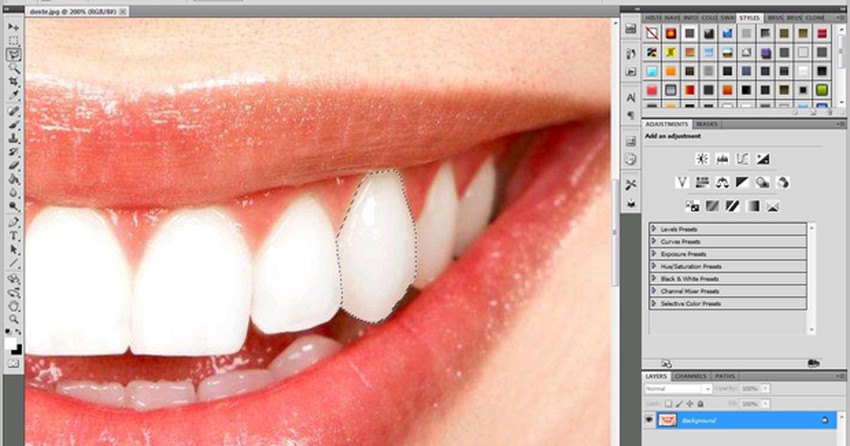 Como Deixar Os Dentes Pontudos Iguais A De Um Vampiro Dicas E Tutoriais Techtudo