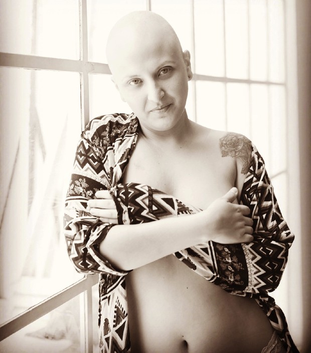 Carolina Sanoviz, de 26 anos, que descobriu o câncer em 2015 (Foto: Antonio Brasiliano)