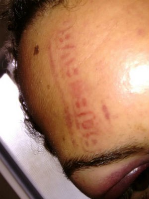Garçom disse não saber como assaltante fez marca em sua testa (Foto: Arquivo pessoal)