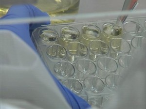 Contato com os vírus das doenças é dado por meio do intestino do inseto. (Foto: Reprodução / TV TEM) Contato com os vírus das doenças é dado por meio do intestino do inseto. (Foto: Reprodução / TV TEM)