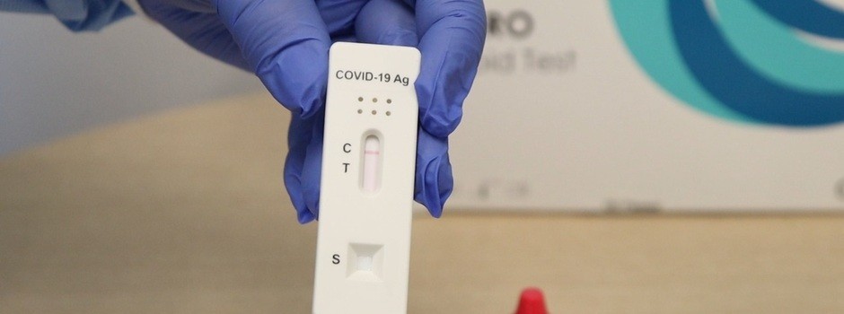 Teste rápido para detecção de antígeno Sars-CoV-2 (Foto: Fábio Marchetto/SES-MG )