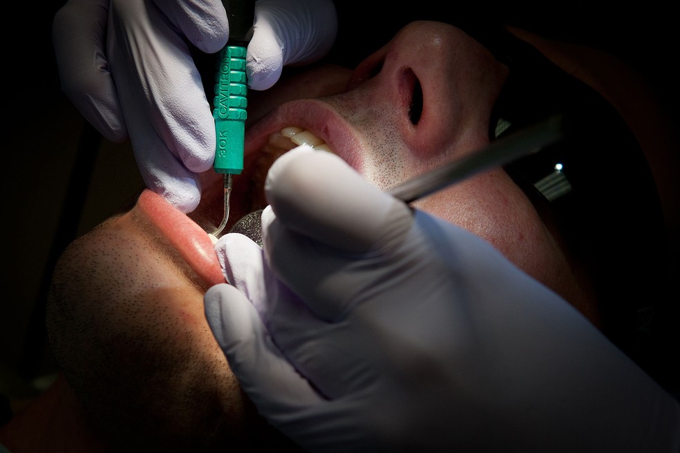 Pessoas com doença periodontal têm risco aumentado para hipertensão — Foto: https://commons.wikimedia.org/w/index.php?curid=41412730