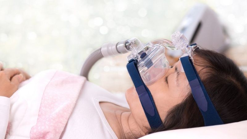 Em alguns casos de apneia, os médicos indicam o uso de CPAP, um equipamento que mantém aberta a passagem de ar na garganta (Foto: Getty Images via BBC News)