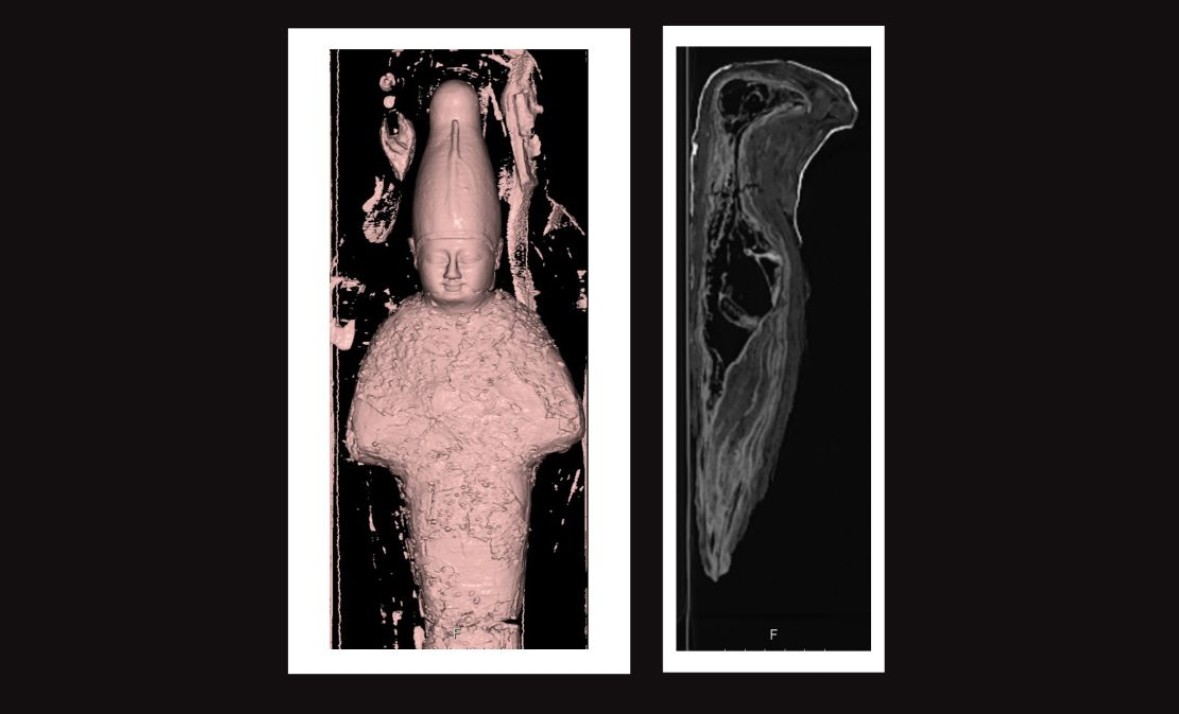 Tomografias revelaram que uma das múmias era, na verdade, um objeto feito de argila e grãos; já a outra era o cadáver de uma ave (Foto: Rambam Health Care Campus)