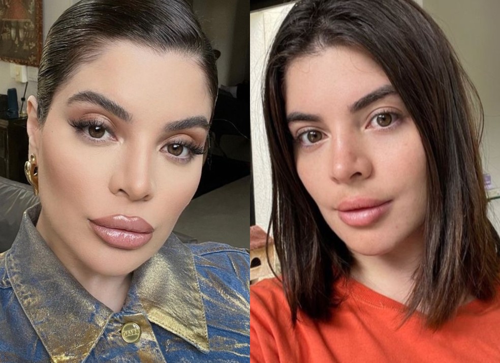 Gkay mostrando resultado da retirada do procedimento labial &mdash; Foto: Reprodu&ccedil;&atilde;o / Instagram