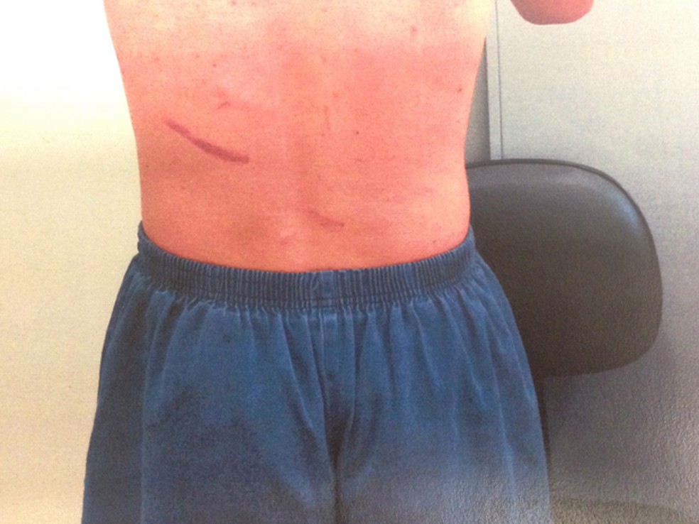 Adolescente interno da Fundação Casa com marcas de agressão — Foto: Defensoria Pública