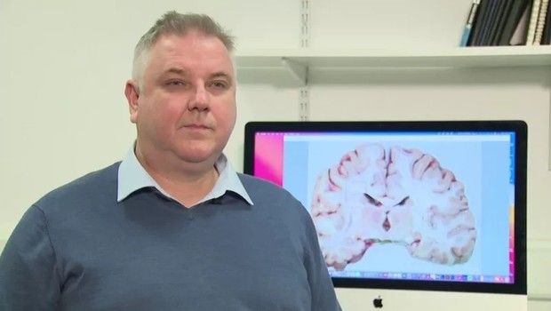 O professor Colin Smith disse que o uso do tecido cerebral armazenado em uma investigação de assassinato foi algo "muito, muito incomum, se não excepcional" (Foto: BBC)