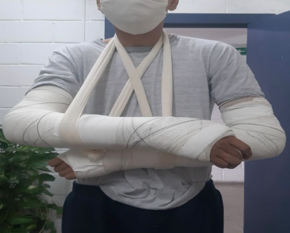 Adolescente precisou engessar os dois braços devido a lesão no pulso em Fundação Casa de São Vicente, SP — Foto: Arquivo Pessoal