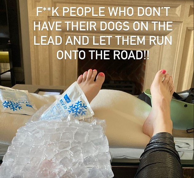 A foto compartilhada pela atriz Rebel Wilson mostrando sua perna lesionada após acidente enquanto passeava de bicicleta por Londres (Foto: Instagram)