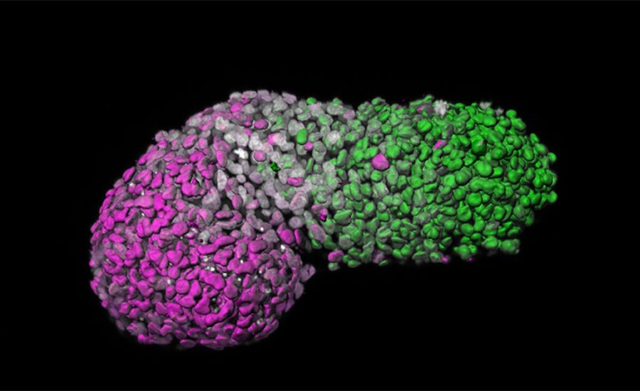 Modelo de embrião humano é criado a partir de células-tronco (Foto: Naomi Moris/University of Cambridge)