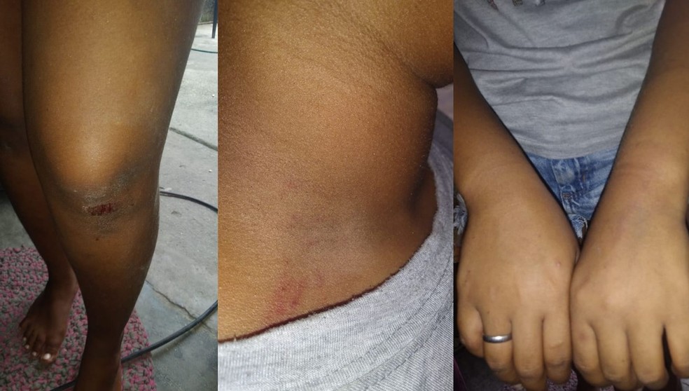 A adolescente mostrou que está com marcas e ferimentos pelo corpo — Foto: Reprodução/WhatsApp